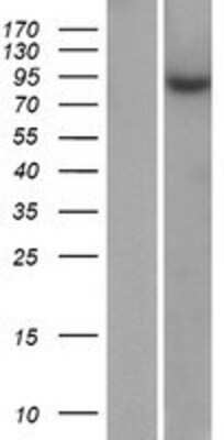 Western Blot: ZNF425 Overexpression Lysate [NBP2-08954]