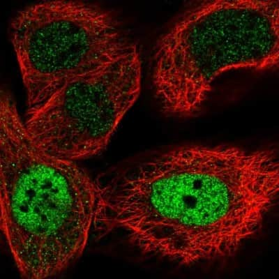 Immunocytochemistry/ Immunofluorescence: ZNF426 Antibody [NBP1-81149]