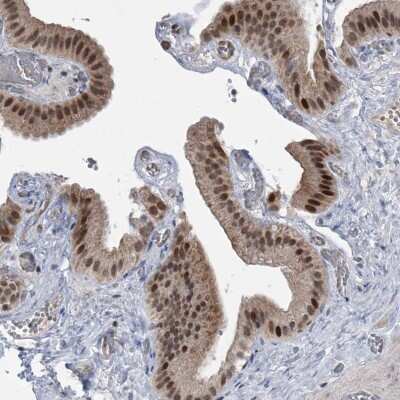Immunohistochemistry-Paraffin: ZNF426 Antibody [NBP1-81149]