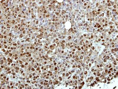 Immunohistochemistry-Paraffin: ZNF426 Antibody [NBP2-21015]