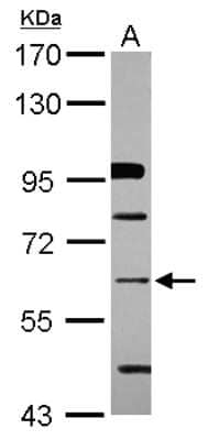 Western Blot: ZNF426 Antibody [NBP2-21015]