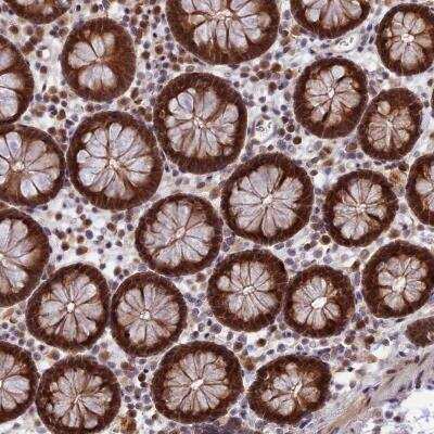 Immunohistochemistry: ZNF428 Antibody [NBP2-31922]