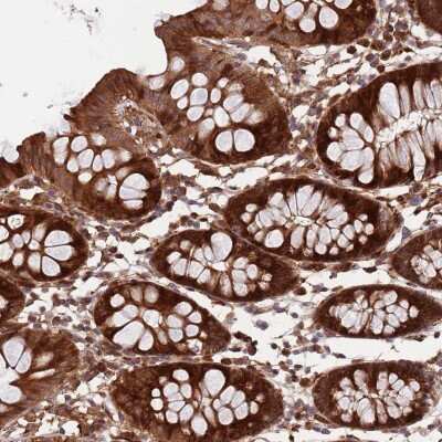 Immunohistochemistry: ZNF428 Antibody [NBP2-32060]