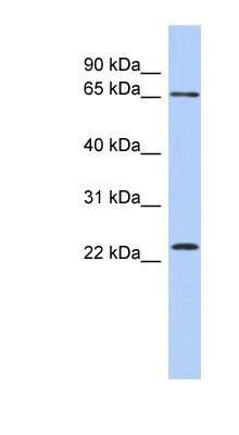 Western Blot: ZNF428 Antibody [NBP1-79973]