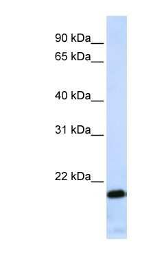 Western Blot: ZNF428 Antibody [NBP1-80435]