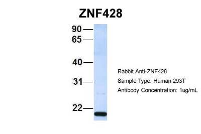 Western Blot: ZNF428 Antibody [NBP1-80435]