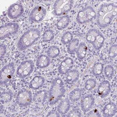 Immunohistochemistry-Paraffin: ZNF43 Antibody [NBP2-13573]