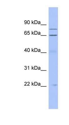 Western Blot: ZNF431 Antibody [NBP1-80392]