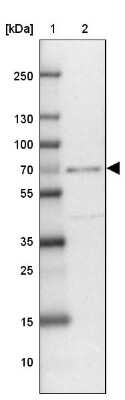 Western Blot: ZNF432 Antibody [NBP2-31813]