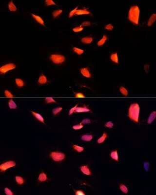 Immunocytochemistry/ Immunofluorescence: ZNF433 Antibody - Azide and BSA Free [NBP3-05110]