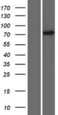 Western Blot: ZNF433 Overexpression Lysate [NBP2-08489]