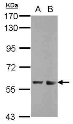 Western Blot: ZNF434 Antibody [NBP2-21016]