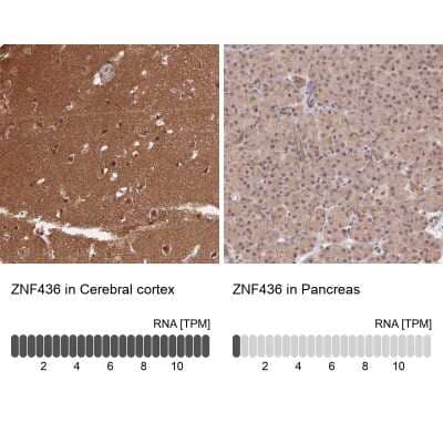 Immunohistochemistry-Paraffin: ZNF436 Antibody [NBP1-82897]