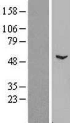 Western Blot: ZNF436 Overexpression Lysate [NBL1-18154]