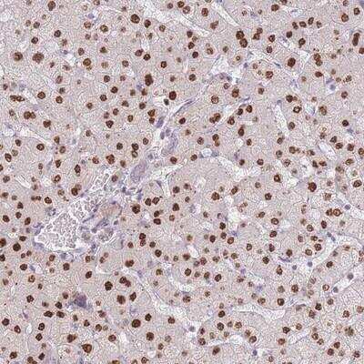 Immunohistochemistry-Paraffin: ZNF439 Antibody [NBP2-13574]