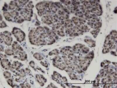 Immunohistochemistry-Paraffin: ZNF44 Antibody (4E2) [H00051710-M01]