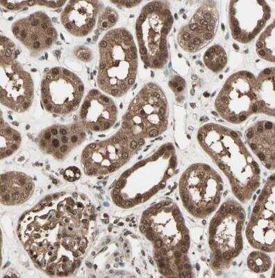 Immunohistochemistry-Paraffin: ZNF44 Antibody [NBP1-81344]