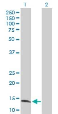 Western Blot: ZNF44 Antibody [H00051710-D01P]