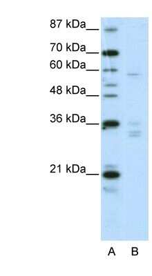 Western Blot: ZNF440 Antibody [NBP1-80404]