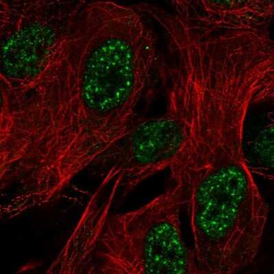 Immunocytochemistry/ Immunofluorescence: ZNF441 Antibody [NBP2-56529]