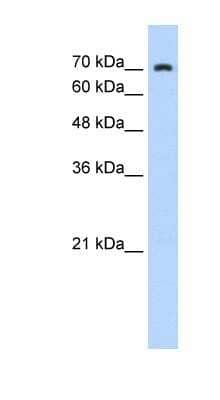 Western Blot: ZNF441 Antibody [NBP1-80153]