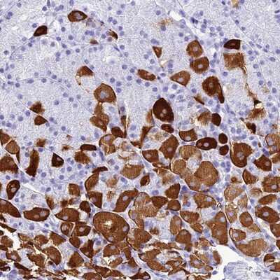 Immunohistochemistry-Paraffin: ZNF442 Antibody [NBP1-92625]