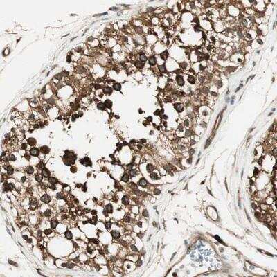 Immunohistochemistry-Paraffin: ZNF443 Antibody [NBP1-80599]