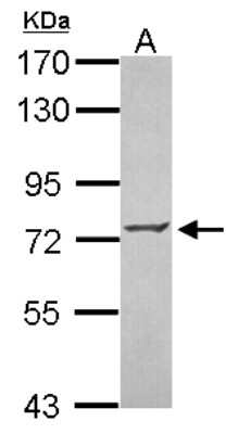 Western Blot: ZNF443 Antibody [NBP2-21018]