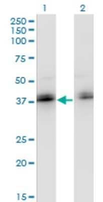 Western Blot: ZNF444 Antibody (4E9) [H00055311-M02]