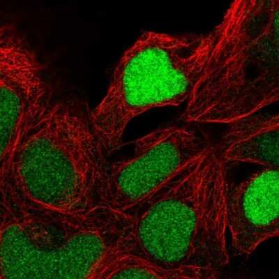 Immunocytochemistry/ Immunofluorescence: ZNF444 Antibody [NBP2-56263]