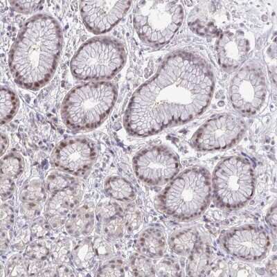 Immunohistochemistry-Paraffin: ZNF444 Antibody [NBP2-33802]
