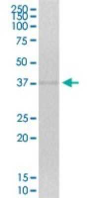 Western Blot: ZNF444 Antibody [H00055311-B01P]