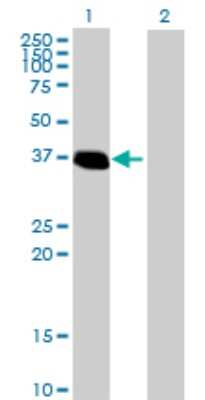 Western Blot: ZNF444 Antibody [H00055311-B01P]