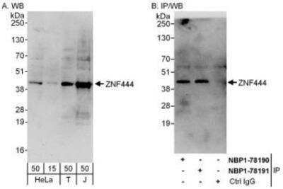 Western Blot: ZNF444 Antibody [NBP1-78190]