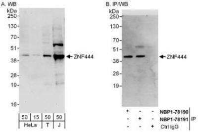 Western Blot: ZNF444 Antibody [NBP1-78191]