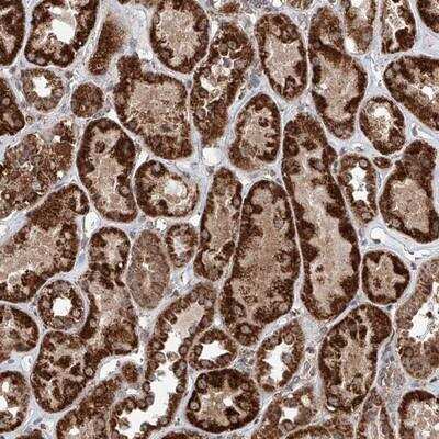 Immunohistochemistry-Paraffin: ZNF445 Antibody [NBP1-80598]