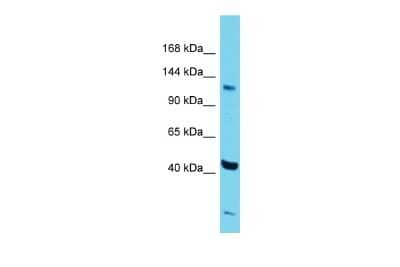 Western Blot: ZNF445 Antibody [NBP3-10444]