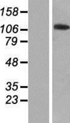 Western Blot: ZNF445 Overexpression Lysate [NBP2-04907]