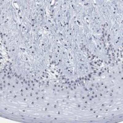 Immunohistochemistry-Paraffin: ZNF446 Antibody [NBP3-17968]