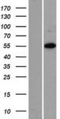 Western Blot: ZNF446 Overexpression Lysate [NBP2-06901]