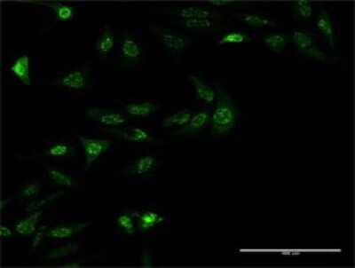 Western Blot: ZNF447 Antibody (2H1) [H00065982-M04]