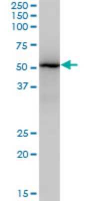 Western Blot: ZNF447 Antibody (2H1) [H00065982-M04]