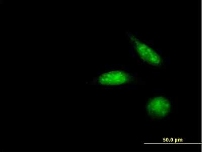 Immunocytochemistry/ Immunofluorescence: ZNF447 Antibody [H00065982-B01P]