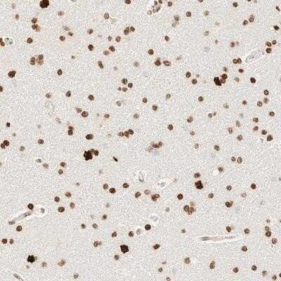 Immunohistochemistry-Paraffin: ZNF447 Antibody [NBP1-87389]