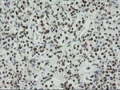 Immunohistochemistry: ZNF447 Antibody (OTI2H7) - Azide and BSA Free [NBP2-74951]