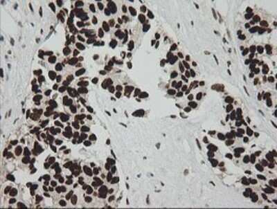 Immunohistochemistry: ZNF447 Antibody (OTI2H7) - Azide and BSA Free [NBP2-74951]