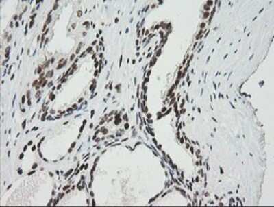 Immunohistochemistry: ZNF447 Antibody (OTI2H7) - Azide and BSA Free [NBP2-74951]