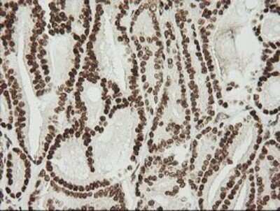 Immunohistochemistry: ZNF447 Antibody (OTI2H7) - Azide and BSA Free [NBP2-74951]