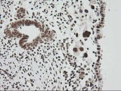 Immunohistochemistry: ZNF447 Antibody (OTI2H7) - Azide and BSA Free [NBP2-74951]