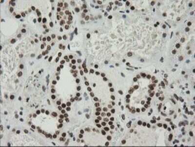 Immunohistochemistry: ZNF447 Antibody (OTI2H7) - Azide and BSA Free [NBP2-74951]